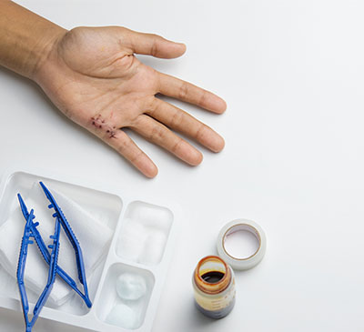 Hydrogel Dressing Market by Product and Geography - Forecast and Analysis 2021-2025